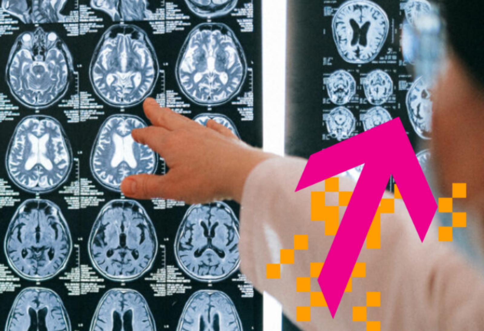 A person is pointing to X-rays of brains