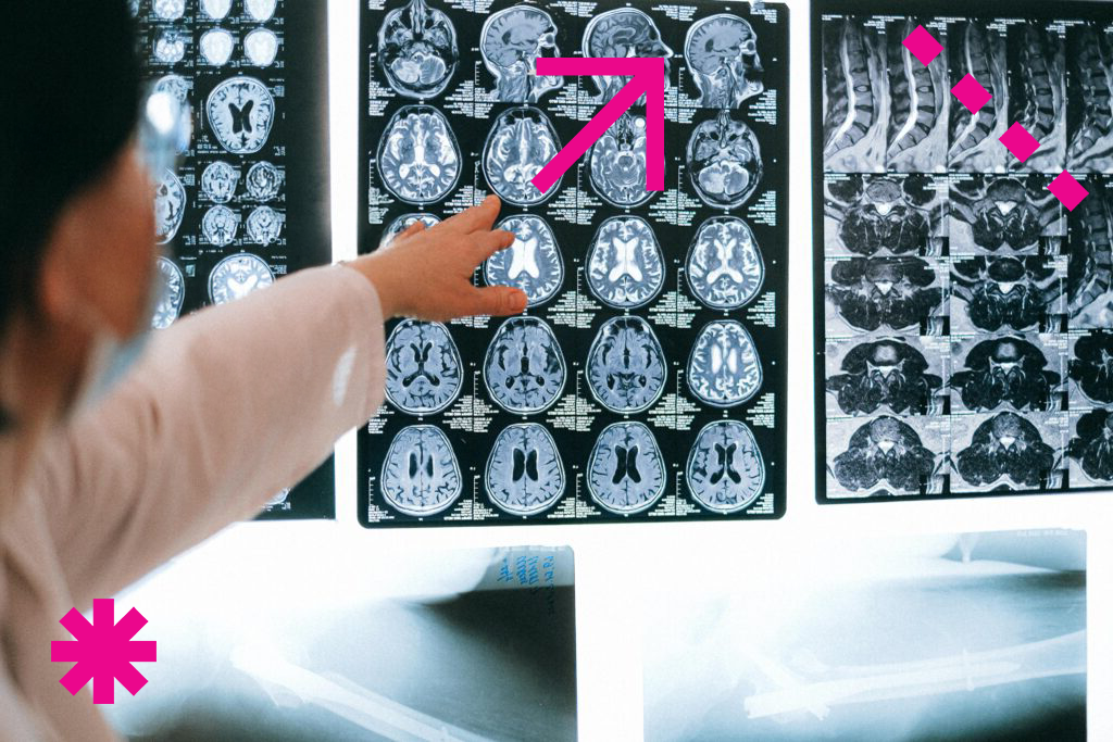 Fastlane graphic - doctor pointing to brain MRI